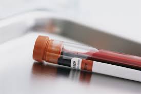 nj dwi blood test